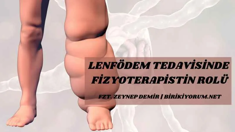 Lenfödem Tedavisinde Fizyoterapistin Rolü