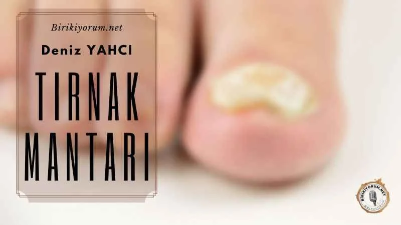Tırnak Mantarı Tedavisi